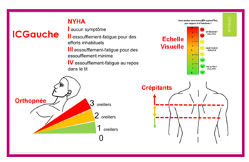 Soirée "présentation du parcours pluripro insuffisance cardiaque" aux médecins du 10e
