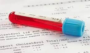 Prélèvements sanguins et vaccins au cabinet infirmiers 
